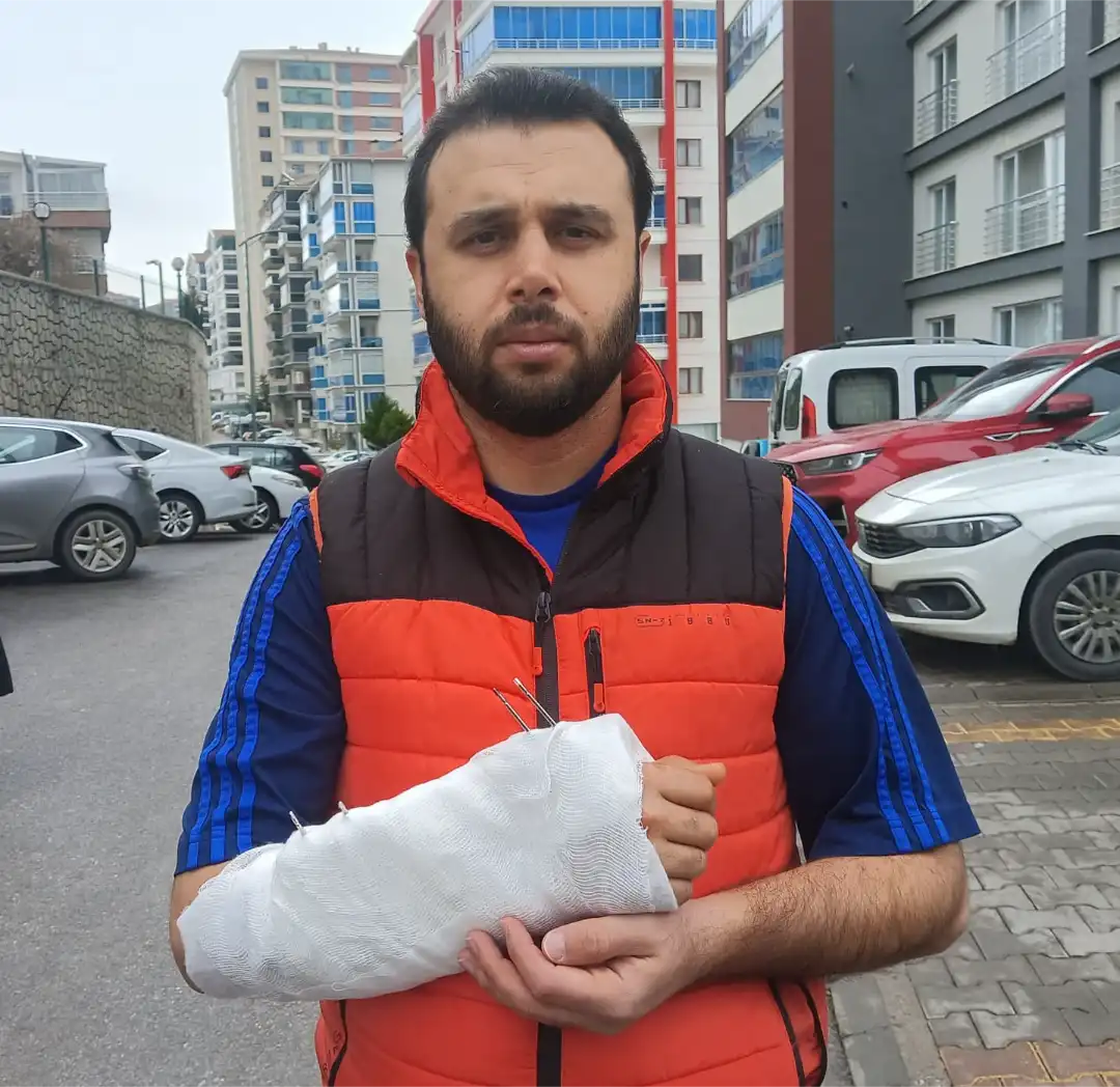 Ankara Mamak’ta sahipsiz köpeklerden kaçarken düşen bir vatandaşın el bileği